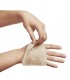 Burnshield Burn Dressing 10cm x 10cm